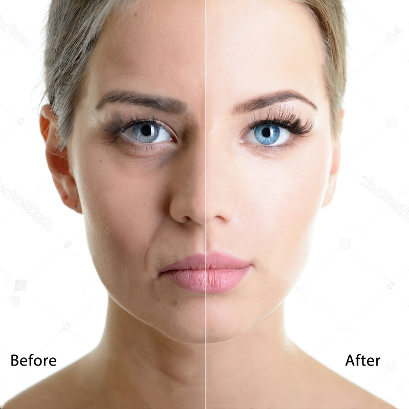 Skin Scrubber Ultrasonic Face Skin Scrubber Facial